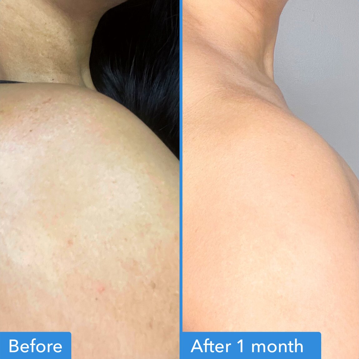 discoloration-correcting-body-treatment-q6 zb_p.jpg