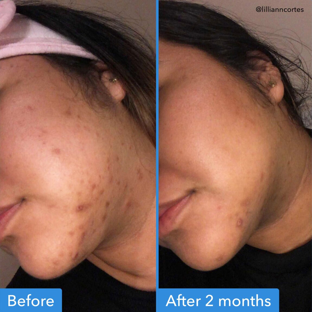 discoloration-correcting-serum-w8 zb_p.jpg