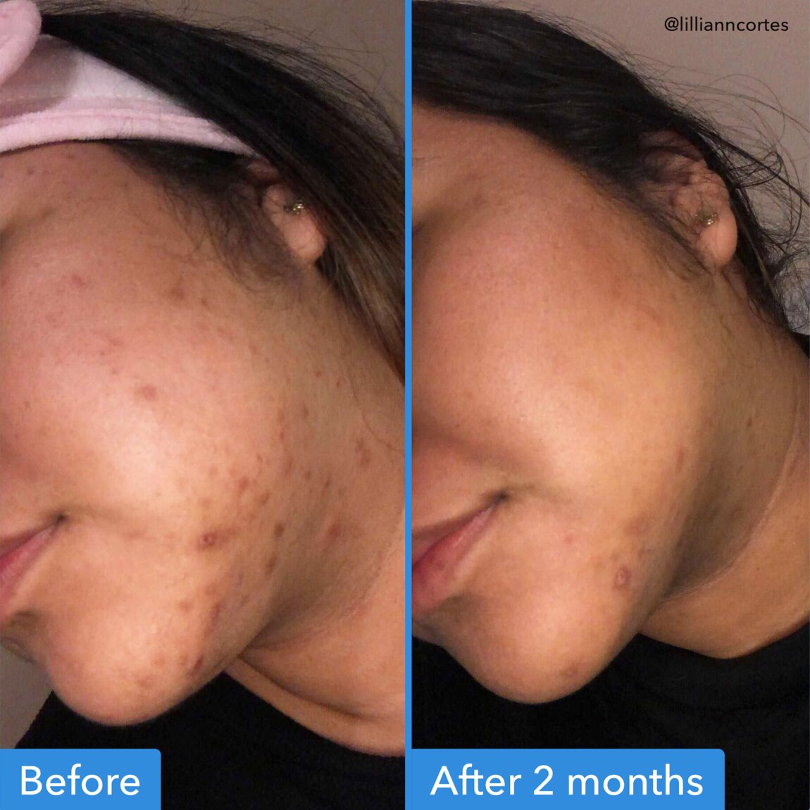 discoloration-correcting-serum-w8 zb_p.jpg