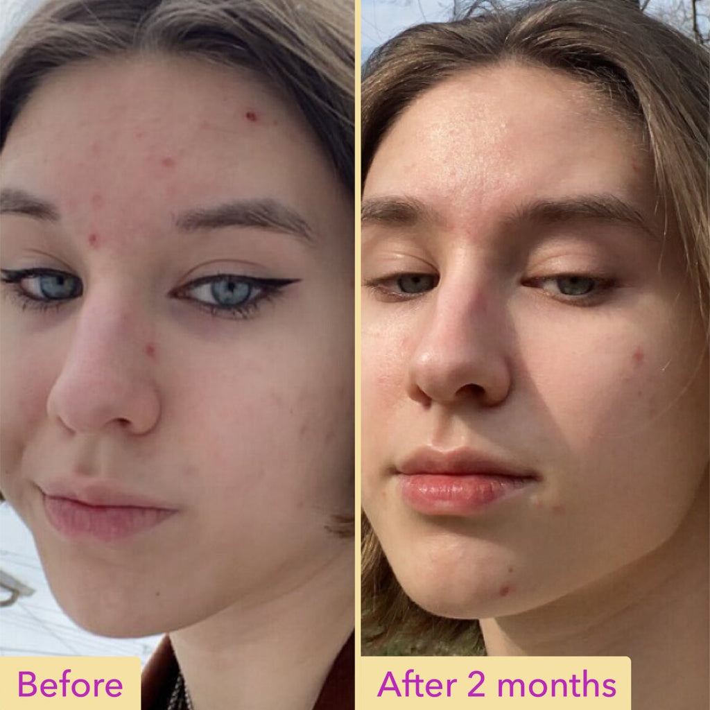 niacinamide-serum-y5 zb_p.jpg