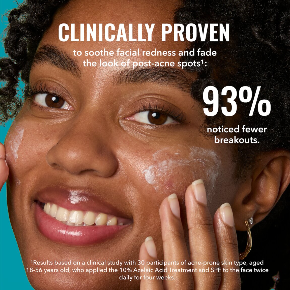 10-azelaic-acid-treatment-c2 zb_p.jpg