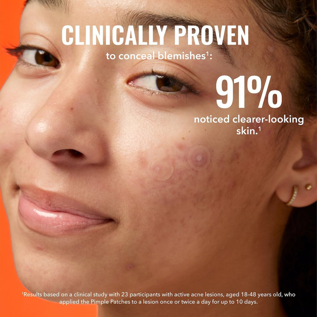 pimple-patches-x1 zb_p.jpg