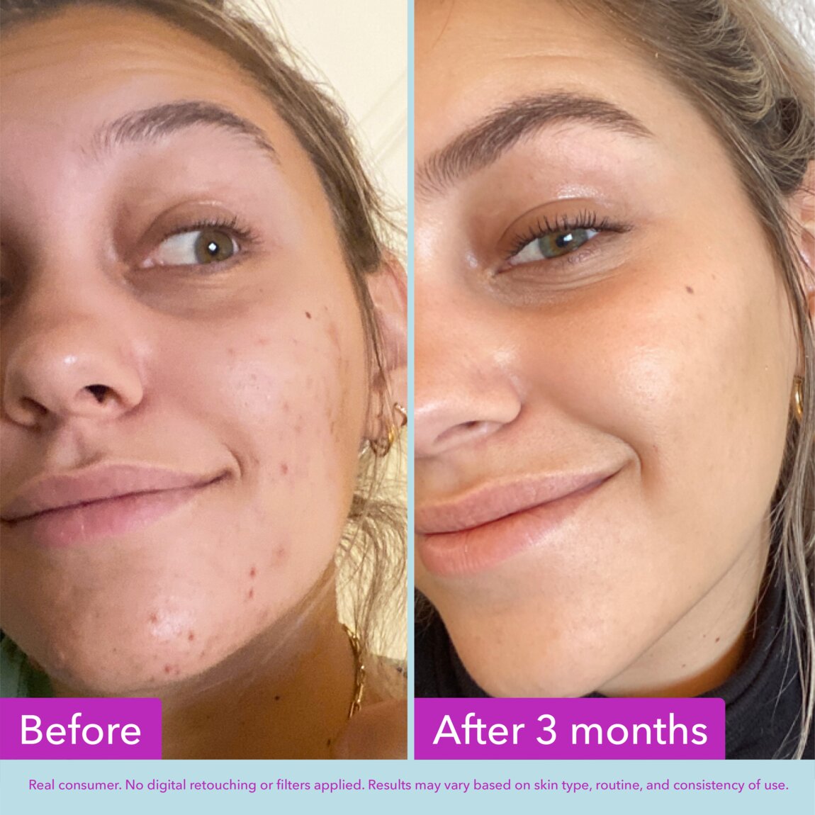 niacinamide-brightening-toner-j6 zb_p.jpg